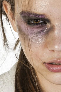 国内代孕服务时突然头晕目眩冒汗的原因分析